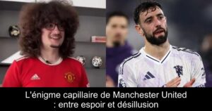 L&rsquo;énigme capillaire de Manchester United : entre espoir et désillusion