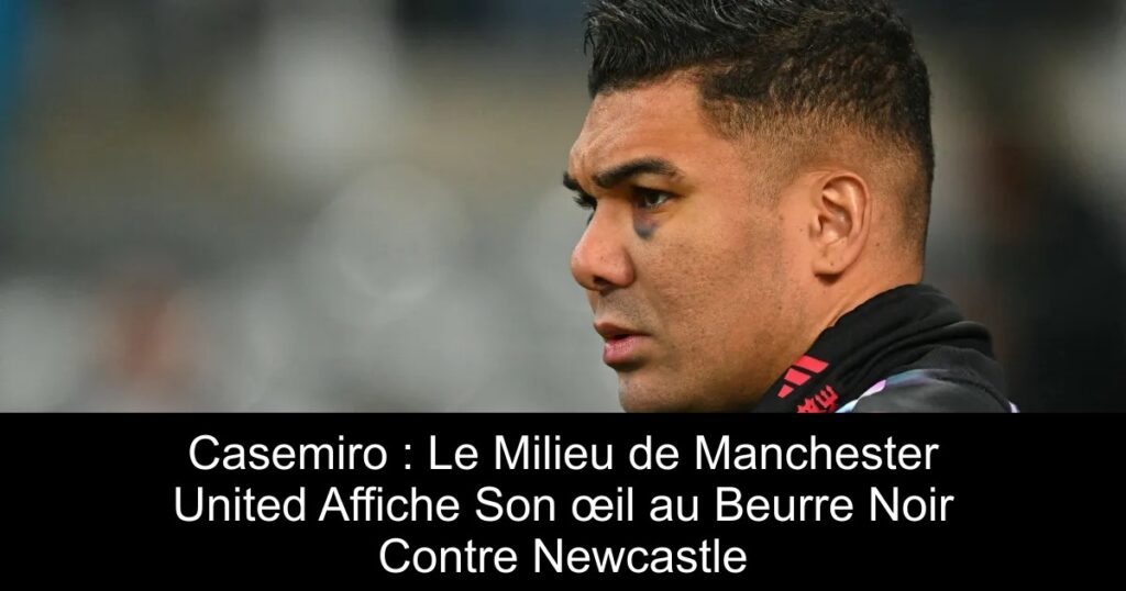 Casemiro : Le Milieu de Manchester United Affiche Son œil au Beurre Noir Contre Newcastle