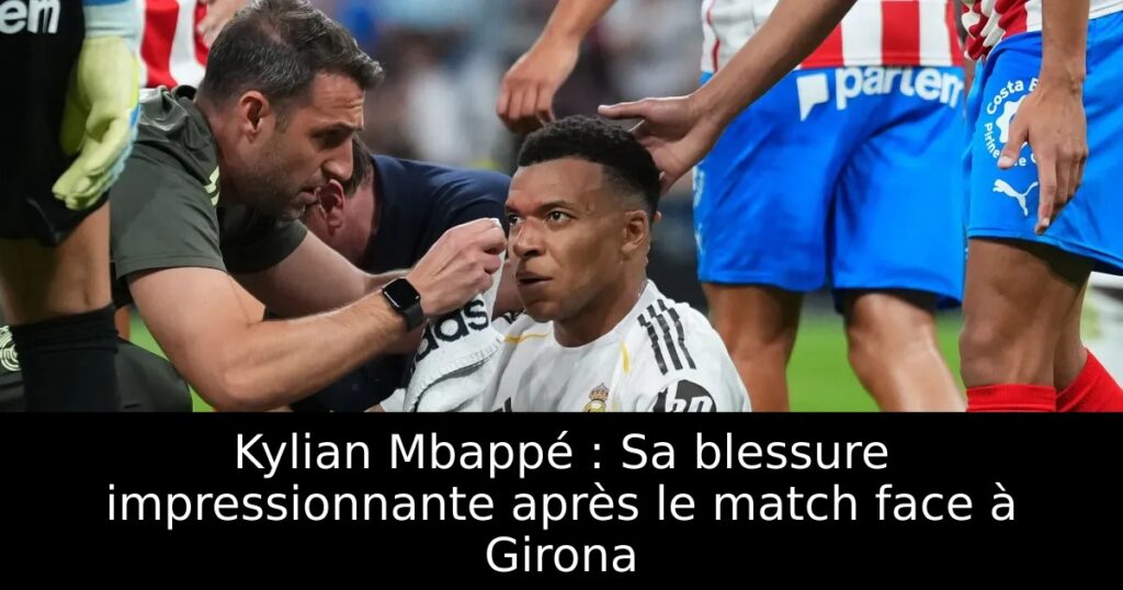 Kylian Mbappé : Sa blessure impressionnante après le match face à Girona