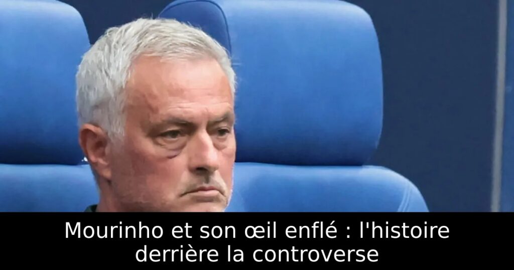 Mourinho et son œil enflé : l&rsquo;histoire derrière la controverse